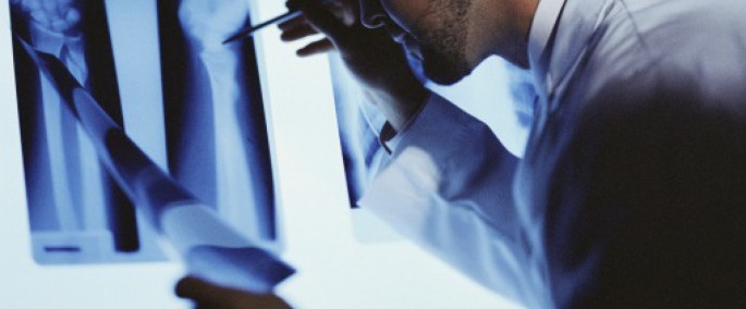 médico mirando radiografía